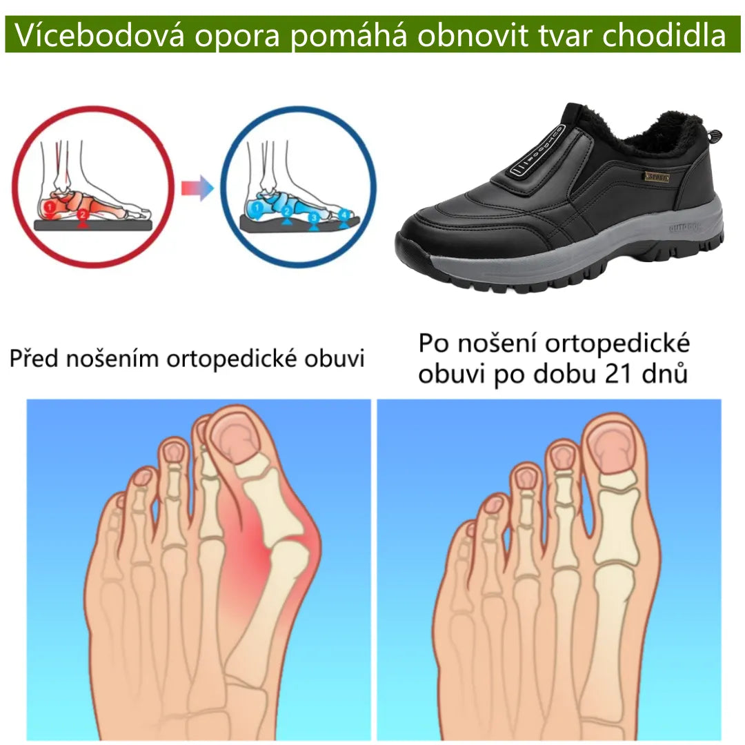 Zimní ortopedická obuv, zateplená s měkkou podšívkou, která ulevuje od bolesti nohou i únavy zad.