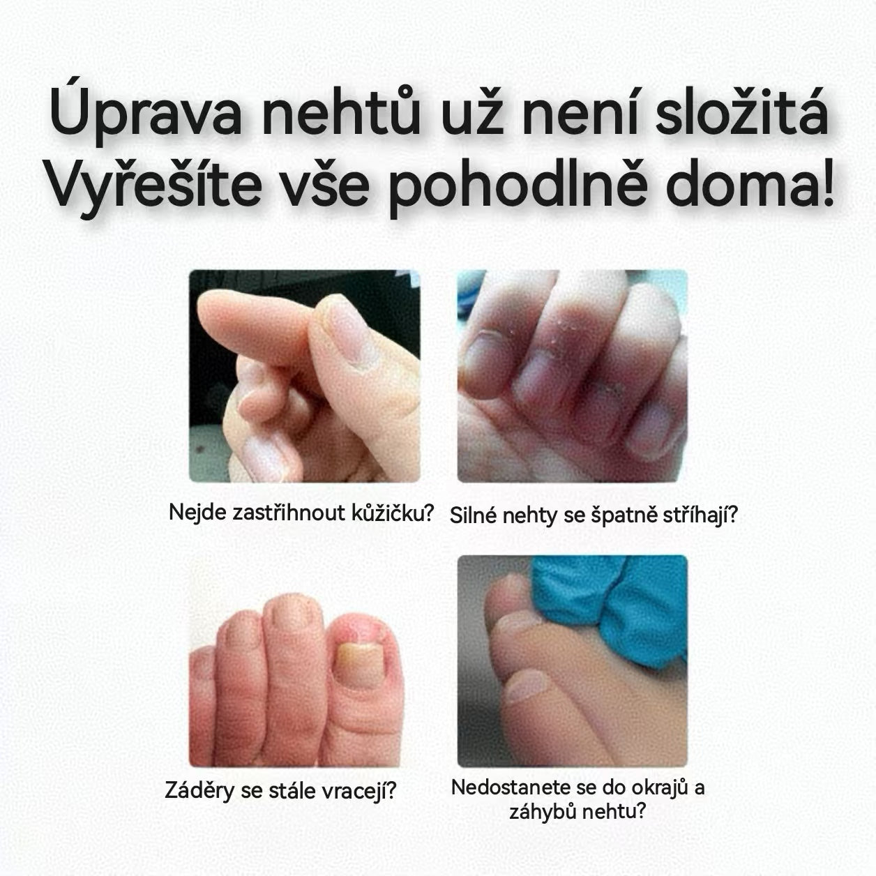Elthivo OrthoClip™ – profesionální nůžky na nehty, ideální pro seniory, diabetiky, pacienty s problémy se zády nebo artritidou
