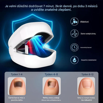 Elthivo Laserové LED zařízení pro léčbu nehtové mykózy