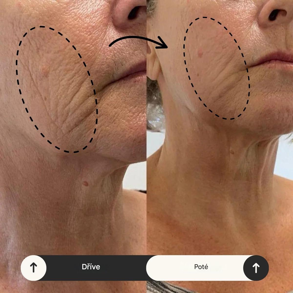 Elthivo™ automatická sprchová hlavice