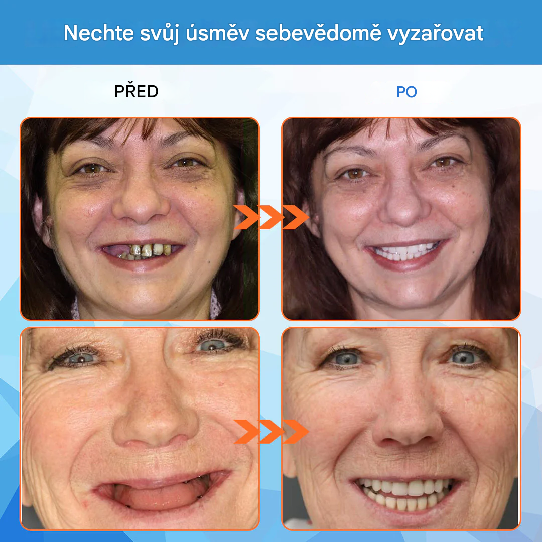 Zubní lékaři důrazně doporučují – keramické zubní náhrady pro seniory 🦷 druhý pár za poloviční cenu 🔥 doporučujeme koupit dva páry do zásoby 🎁