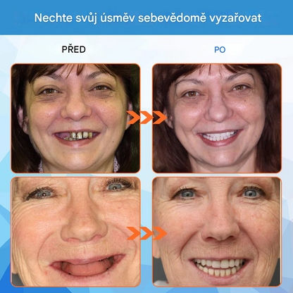 Zubní lékaři důrazně doporučují – keramické zubní náhrady pro seniory 🦷 druhý pár za poloviční cenu 🔥 doporučujeme koupit dva páry do zásoby 🎁