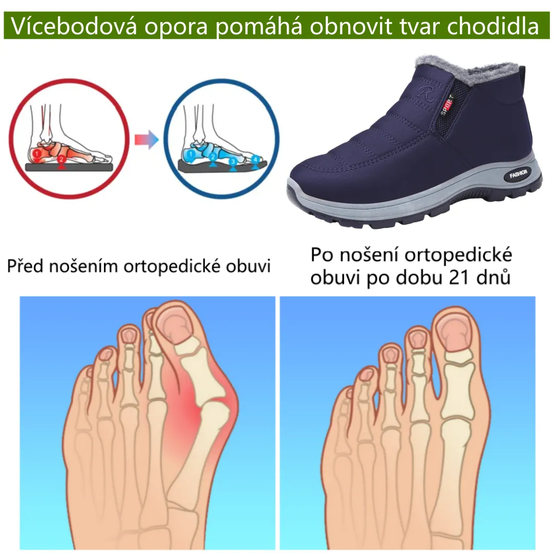 Zimní protiskluzové a zateplené boty pro muže i ženy se slabší rovnováhou – ulevují od tlaku na kolena