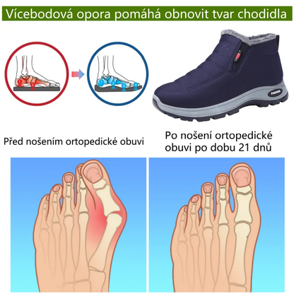 Zimní protiskluzové a zateplené boty pro muže i ženy se slabší rovnováhou – ulevují od tlaku na kolena