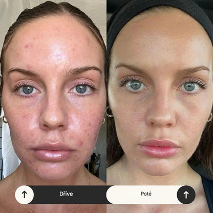 Elthivo™ automatická sprchová hlavice