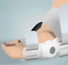 Elthivo Nastavitelný korektor vbočeného palce (Hallux Valgus)